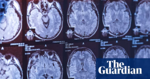 New Development in Canadian Medical Enigma – Audio Series | Scientific Insights