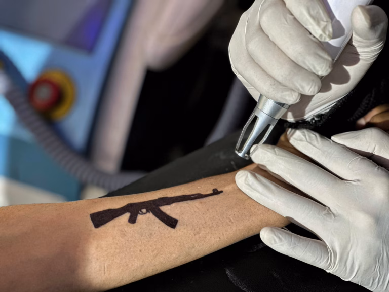 ‘Reality of Fear’: How Youth in Kashmir are Erasing Tattoos of Weapons and ‘Freedom’ Amidst India-Pakistan Strains
