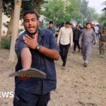 BBC camera operator deeply affected by Gaza’s underfed children affected by Israeli assault