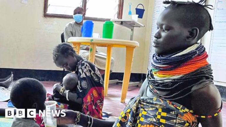 Kakuma Refugee Camp Faces Malnutrition Crisis Following Reduction in US Assistances