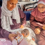Gaza Mother’s Eased Anxiety as Severely Malnourished Infant Transported to Jordan for Care