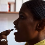 India Witnesses Rising Superbug Epidemic Amidst Declining Antibiotic Access