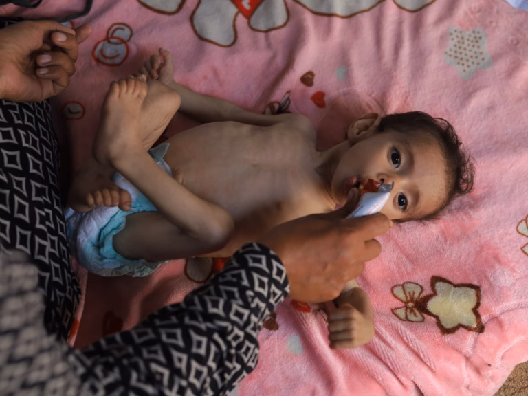 Warning Issued by UN: Malnutrition Levels Rising Sharply Among Palestine’s Younger Population in Gaza | Latest on Food Security
