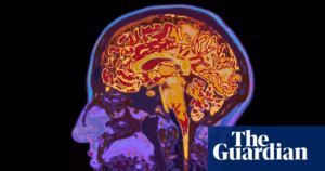 “Protecting Your Brain: The Call for a Comprehensive Dementia Prevention Push in Australia” | Health