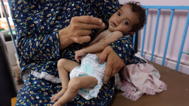 One-quarter of youngsters and expectant mothers in Gaza suffer from malnutrition, reports a non-profit organization, while the prime minister pledges to transport urgent medical cases to the United Kingdom.