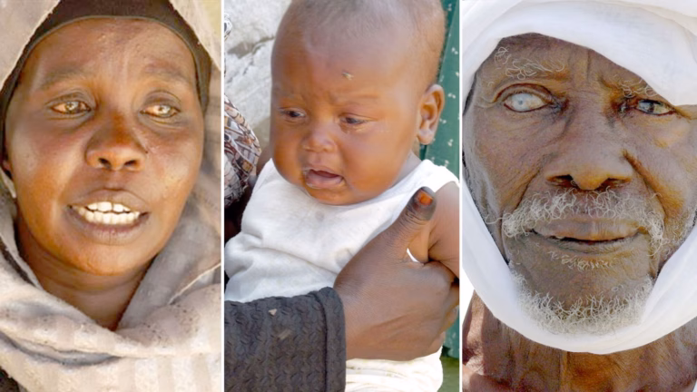 Sudan Conflict: Brutality and Hunger Grip City Amidst Military Crackdown | Global Affairs